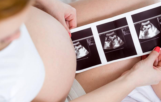 看懂四维彩超单图片,怎么看懂四维彩超上面的数据