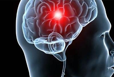 弱激光治疗心脑血管病,弱激光治疗仪可以降血压吗