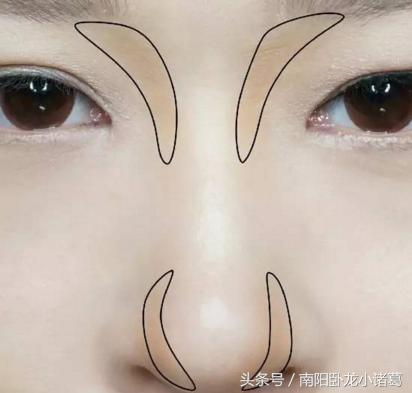 南阳时光整形除皱术,南阳时光假体隆鼻