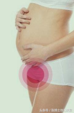 孕妇耻骨痛怎么锻炼,孕期耻骨疼多锻炼可以缓解吗