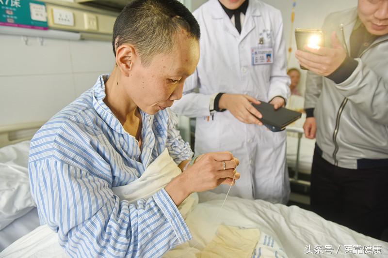 大脑植入电极治疗帕金森,帕金森治疗植入电极