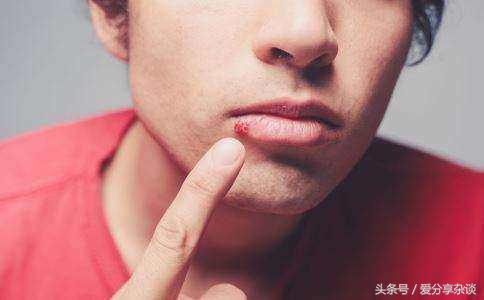 嘴巴起泡了怎么办快速消除,嘴巴起泡最快的解决方法