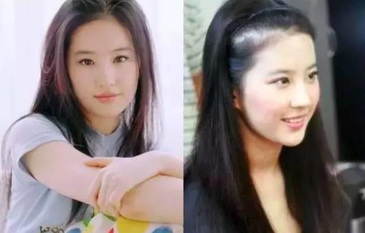 头发越掉越多？梳一梳就长回来了，你信不信！