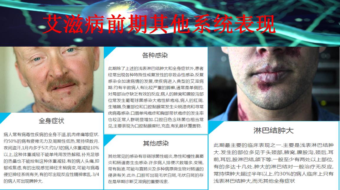 “伪装大师”艾滋病有哪些神经系统表现？头疼脑热不要轻易放过！