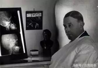 他用一根长钉从眼眶锤入那个人的头颅竟只为了治精神病