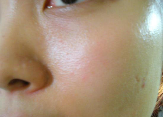 毛孔粗大做深层清洁能改善吗,毛孔粗大深层清洁用什么牌子面膜