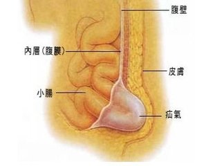 球太硬太鼓怎么办,球大了怎么办妙招