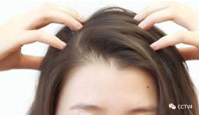 秋天一到就很会掉头发,头发一到秋天就落得厉害是怎么了