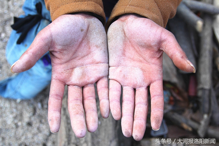 洛阳这个小伙跪地爬行26年：双手布满老茧，两天磨破一条裤子！