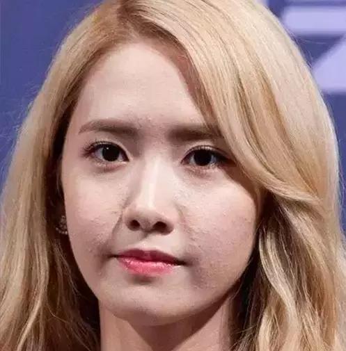 闭口粉刺怎么快速去除小妙招,闭口粉刺怎么快速彻底去除