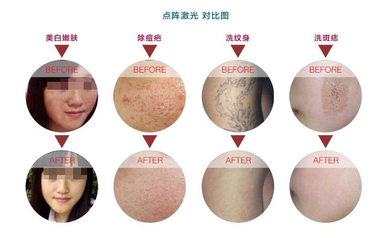 毛孔粗大的成因和解决方法,毛孔粗大成因类型及改善方法