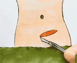 能顺产尽量顺产吗,孕妇能自由选择剖腹产跟顺产吗