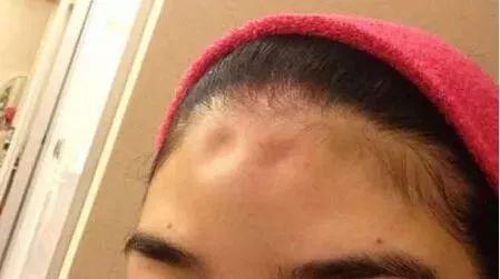 被人砸头怎么赔偿,饭店吃饭被砸应该得到怎样的赔偿