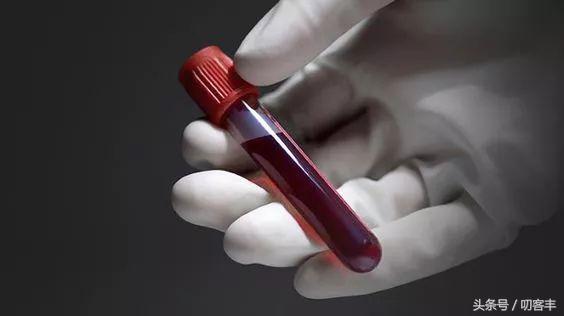 孩子血常规检查白细胞高就是细菌感染吗？