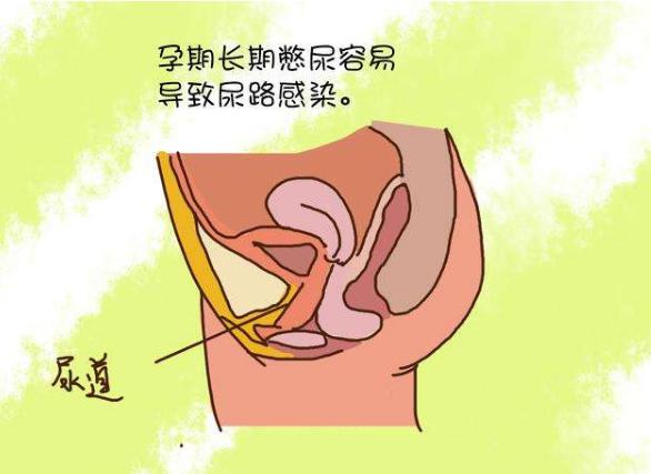 孕妇机智应对尿频,孕妇尿频尿急尿痛怎么办快速缓解