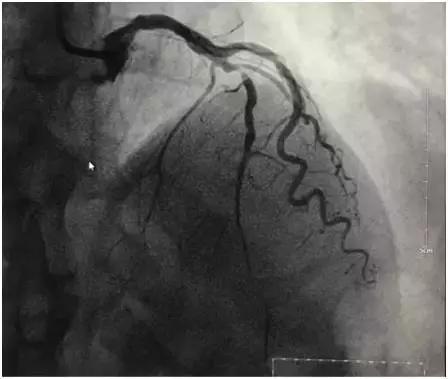 一天抢救两次,一天抢救两次还有救吗