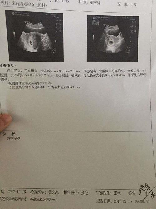 顽固多囊终升级,细数我的好孕经验!接棒吧!