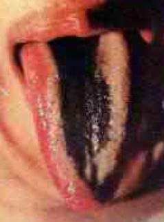 蒲辅周讲舌诊,蒲辅周怎么看舌诊