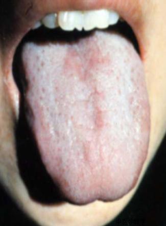 蒲辅周讲舌诊,蒲辅周怎么看舌诊