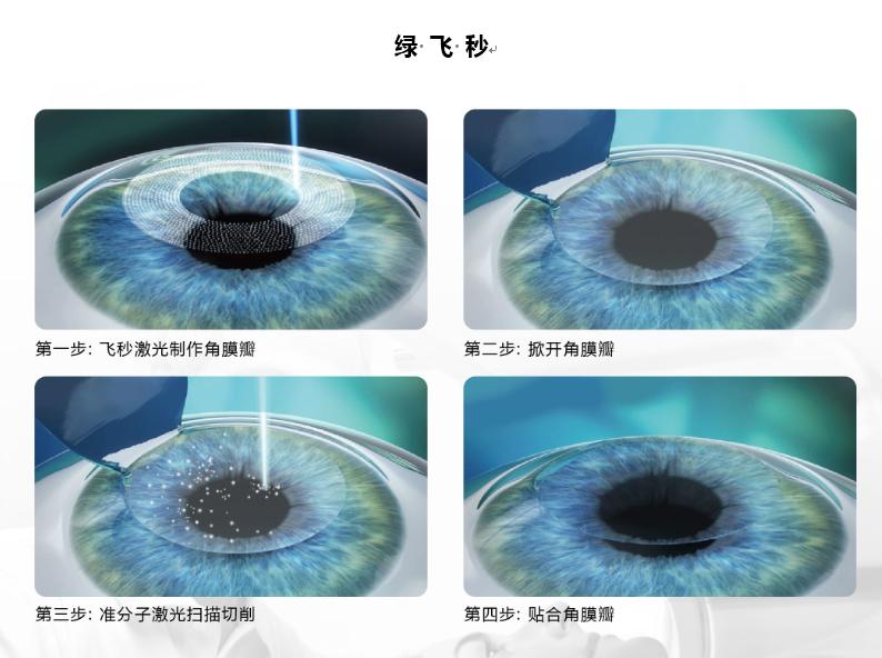 近视矫正出问题的大部分是全飞秒,飞秒近视矫正教程