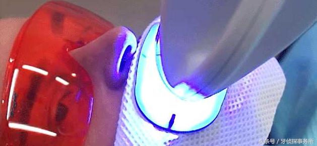 牙齿美白和冷光美白有啥区别,牙齿黄了很多年冷光美白仪有用吗