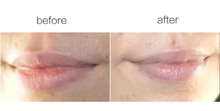 冬季嘴唇干燥起皮用什么唇膏好,十大好用冬季润唇膏排行榜