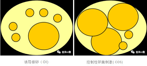 促排卵治疗可以采用的方法,促排卵的治疗方法有哪些