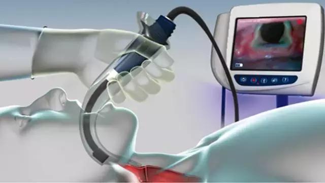 声音嘶哑喉镜没有问题怎么治疗,声音嘶哑为什么医生让做喉镜