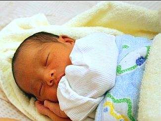 新生儿黄疸的类型及处理方法,新生儿黄疸不用慌消退黄疸有妙招