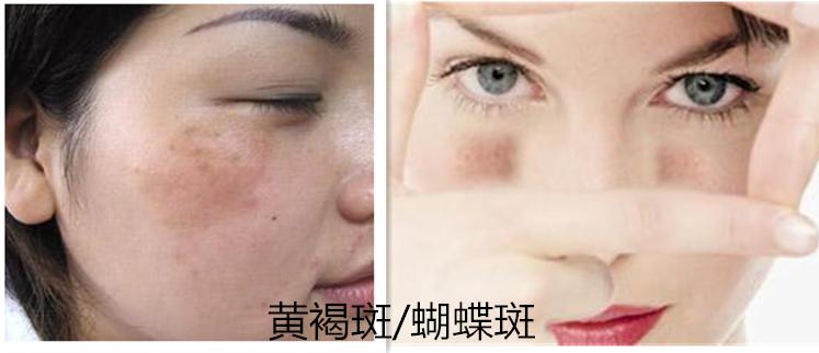 教你如何辨别斑的种类,一张图教你认识身体各个部位