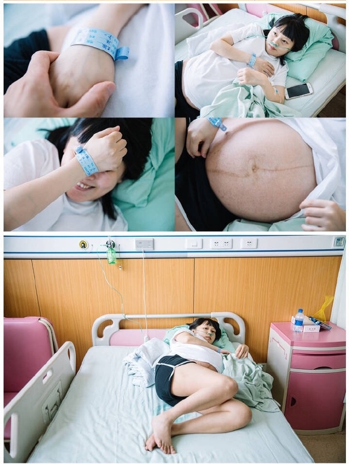 孕期甲减?胎盘低?胎位不正?你的孕期比我更糟心吗?