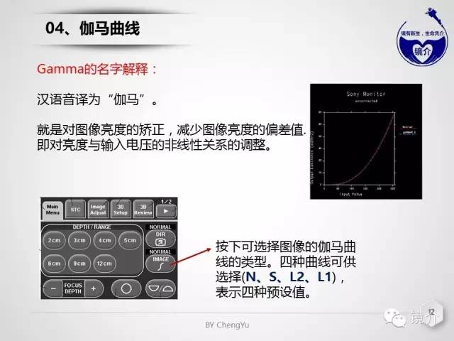 内镜超声小探头设定、使用、维护要点分析