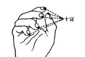 高血压急救的正确方法放血,高血压的中医急救方案