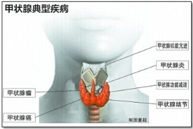 甲状腺的功效与作用,甲状腺结节的作用