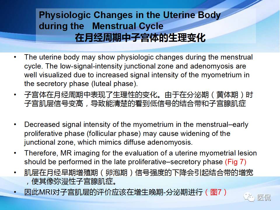 双语PPT：子宫腺肌症常见和不常见的MRI表现医学影像