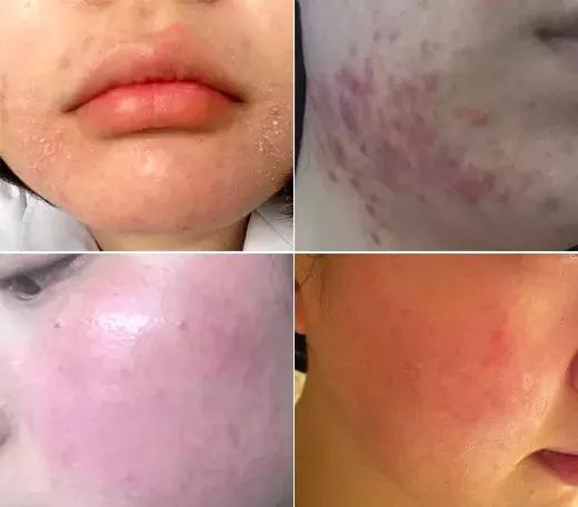 敏感肌卸妆洁面乳,适合敏感肌用的去角质洁面乳