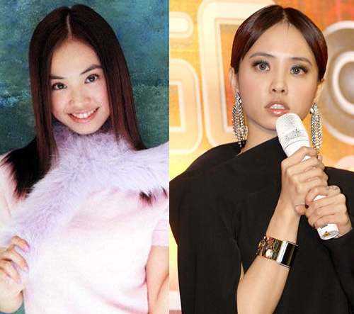 李嫣先天兔唇,天生唇腭裂的李嫣