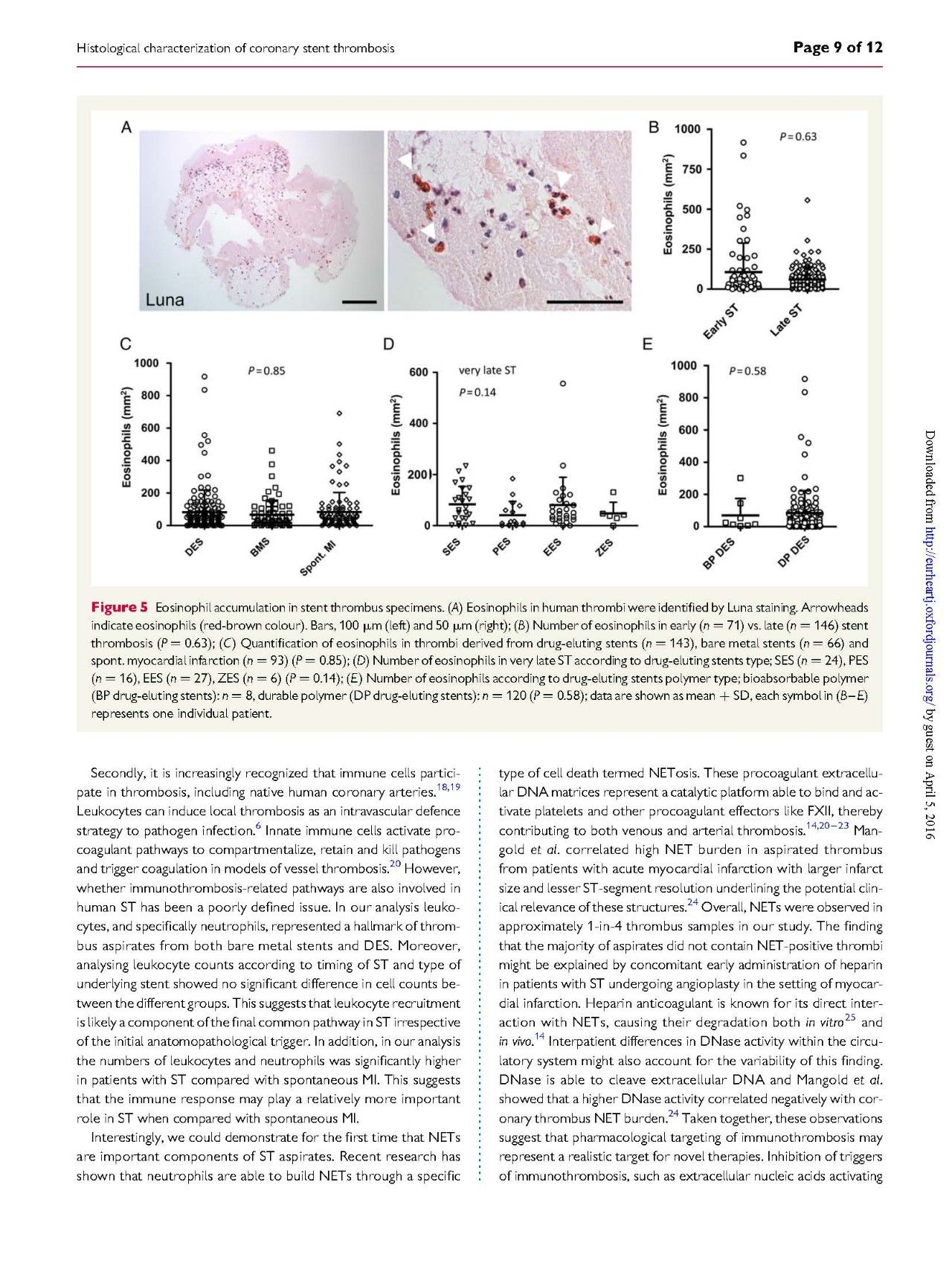 支架内血栓怎么处理,支架内血栓的原因及表现