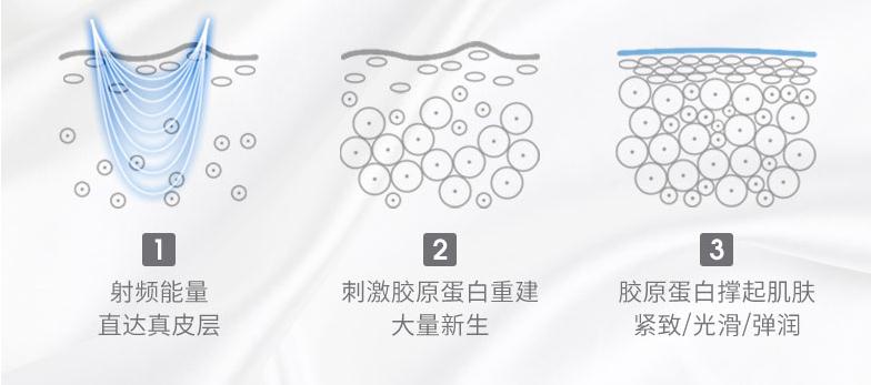 大排灯跟射频美容仪有什么区别,大排灯和射频美容仪可以一起用吗