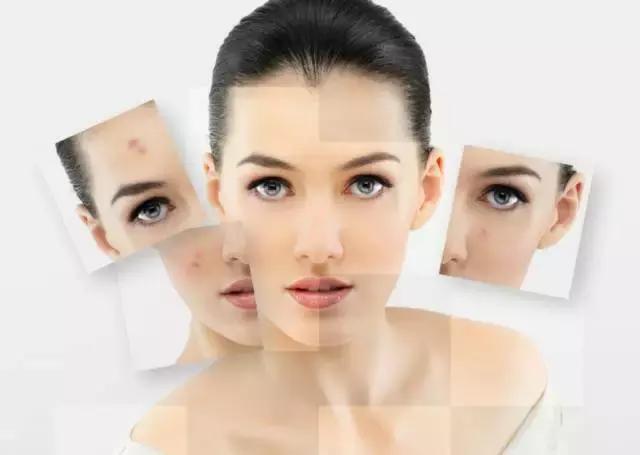 上妆脸上有痘痘怎么办,怎么判断妆有没有卸干净