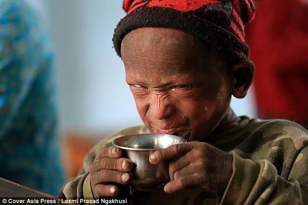 小男孩一出生就得到了一种怪病,男孩从小智力有残缺长大后被孤立