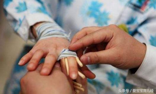 妈妈一时疏忽大意,导致4岁男童3根手指“骨折”!