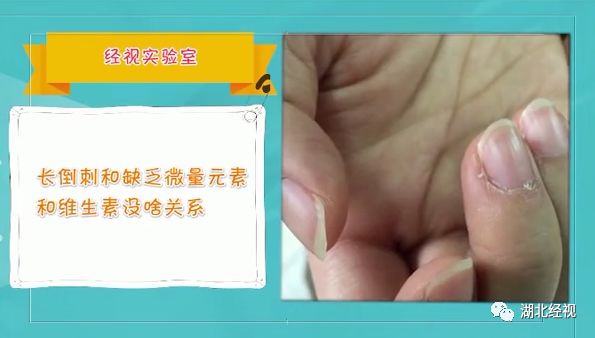 维生素e甘油哪个保湿效果最好,甘油维e保湿