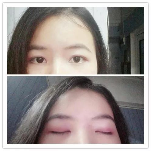 为什么别人的眼睛又亮又好看,为什么别人的眼睛又大又圆