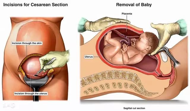 割包皮哪种痛苦最小,割包皮医院排名前十