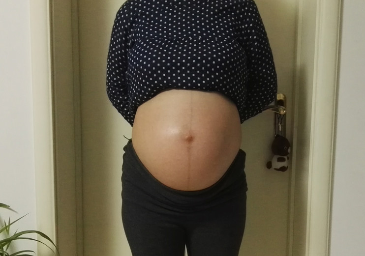 女人生孩子可以选择剖腹产吗,为什么女人生孩子会选择剖腹产