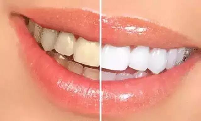 刷牙能让你嘴变香的牙膏,早上不用刷牙可以接吻的牙膏