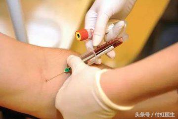 B超查出“多囊卵巢”，是导致我要不上宝宝的病因吗？