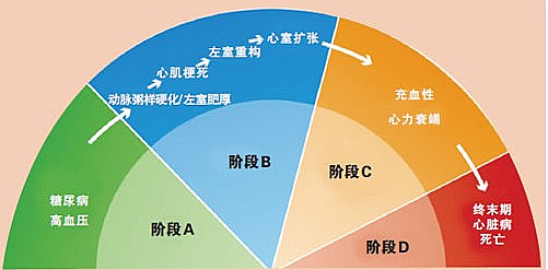 积极降压,精选药物,让高血压肥厚的心肌“瘦”回来!