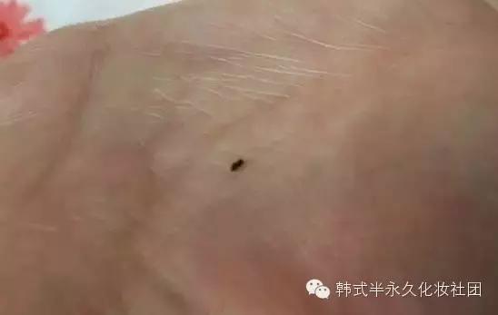 纹美瞳线七天脱痂过程图,纹美瞳线掉痂后反色过程图